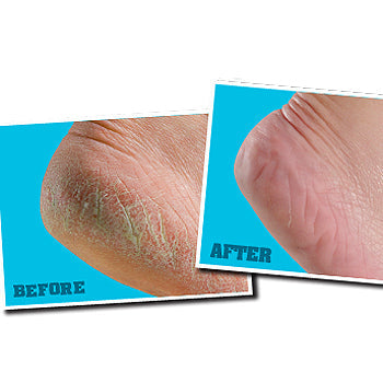 O'keefes Working Feet Cream