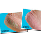 O'keefes Working Feet Cream